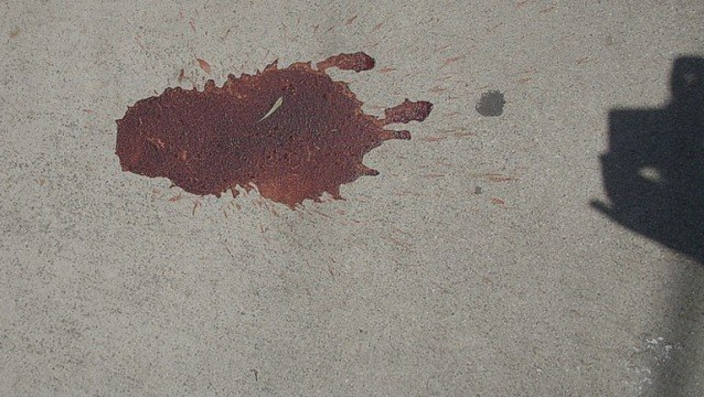 ΙΧ παρέσυρε γυναίκα στη Θεσσαλονίκη - ΠΡΟΣΟΧΗ ΣΚΛΗΡΕΣ ΕΙΚΟΝΕΣ