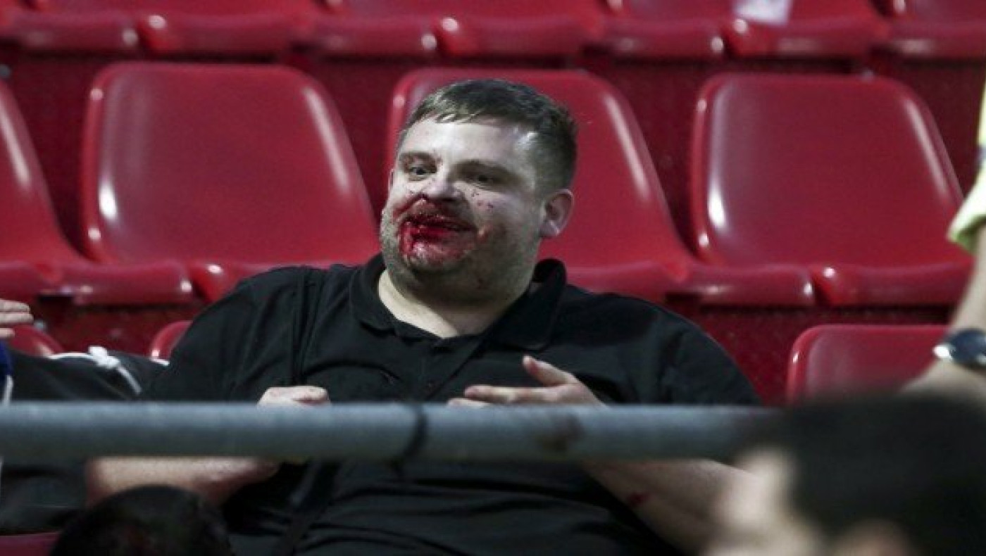 Επίσημη καταγγελία της Μπάγερν για τα επεισόδια στου Ρέντη