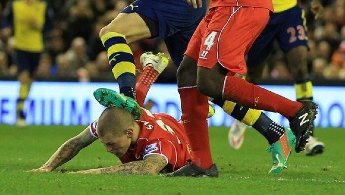 Δέκα τρομακτικά «κεφαλοκτυπήματα»! (pics)