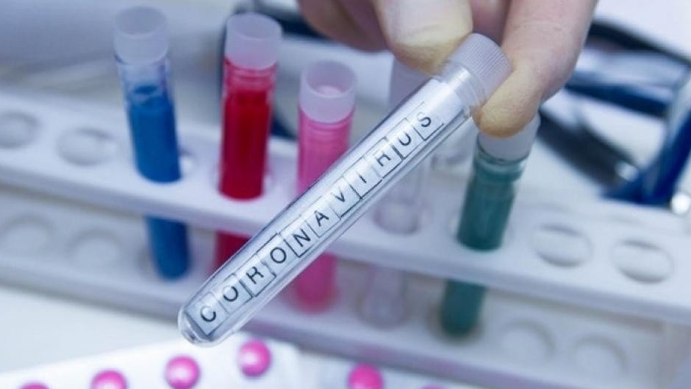 Τρία νέα κρούσματα κορωνοϊού στην Κύπρο