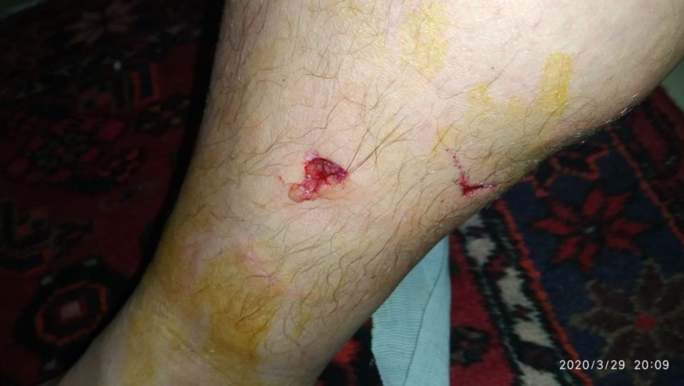 Καλαμαριά: Καταγγελίες για επίθεση σκύλων με ντοκουμέντο