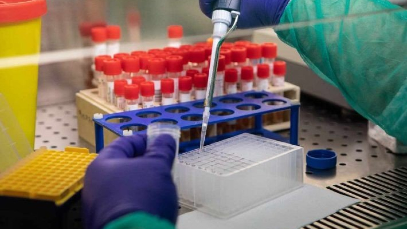 Πρωτοποριακή μελέτη επιστημόνων του Παστέρ σε συνεργασία με Τσιόδρα