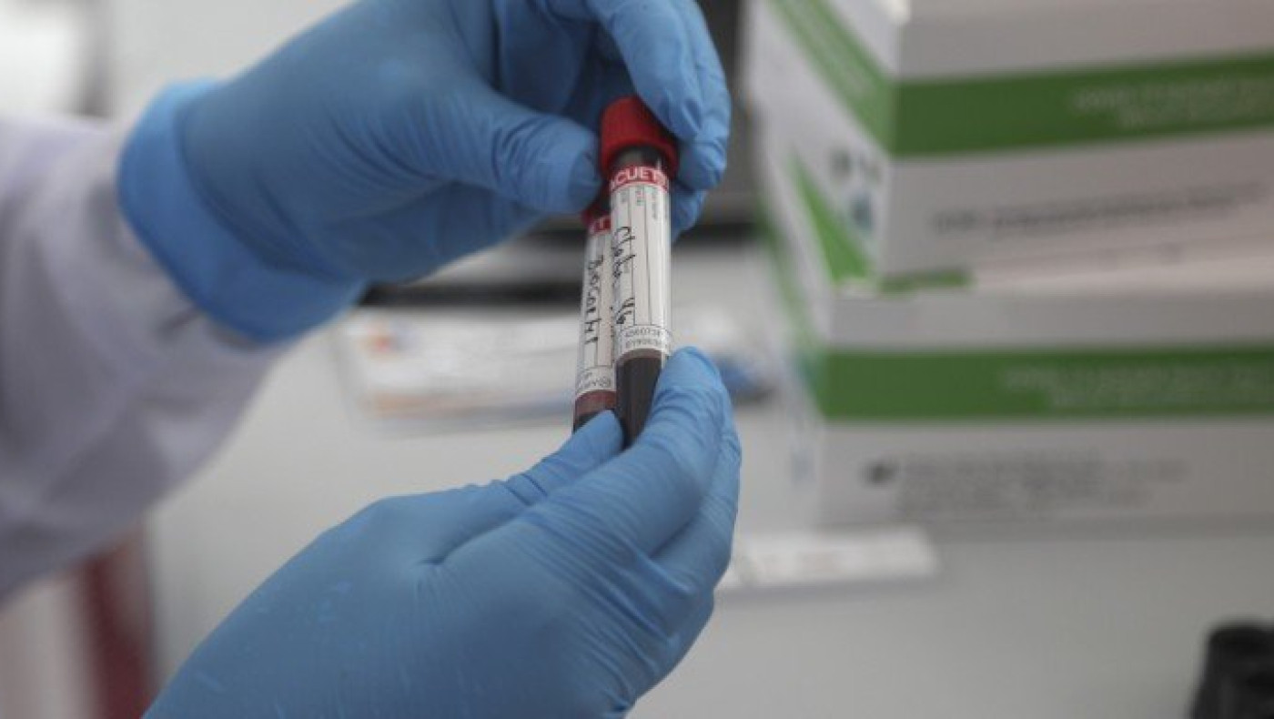 Κορωνοϊός: Γιατί τα τεστ μπορεί να δώσουν ψευδώς αρνητικά αποτελέσματα