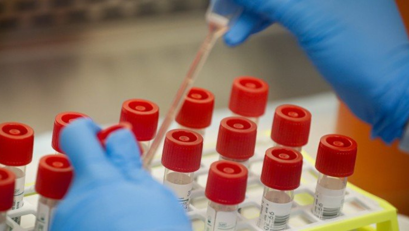 Κορωνοϊός: Η αντίδραση της καθηγήτριας που διαπίστωσε το πρώτο θετικό κρούσμα στην Ελλάδα