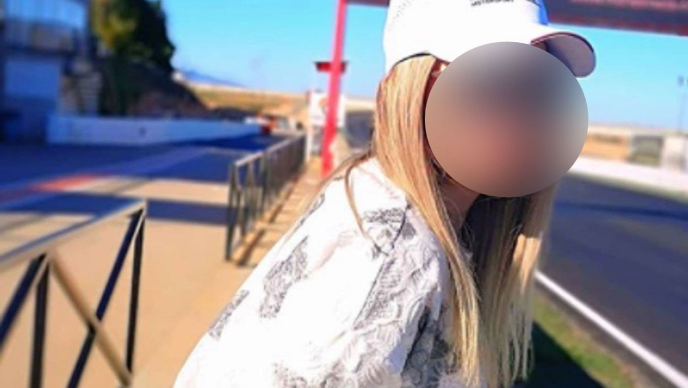 Εγκαύματα στο 93% του προσώπου της έχει η 34χρονη