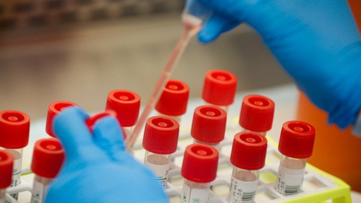 Κορωνοϊός: 15 νέα κρούσματα και ένας θάνατος