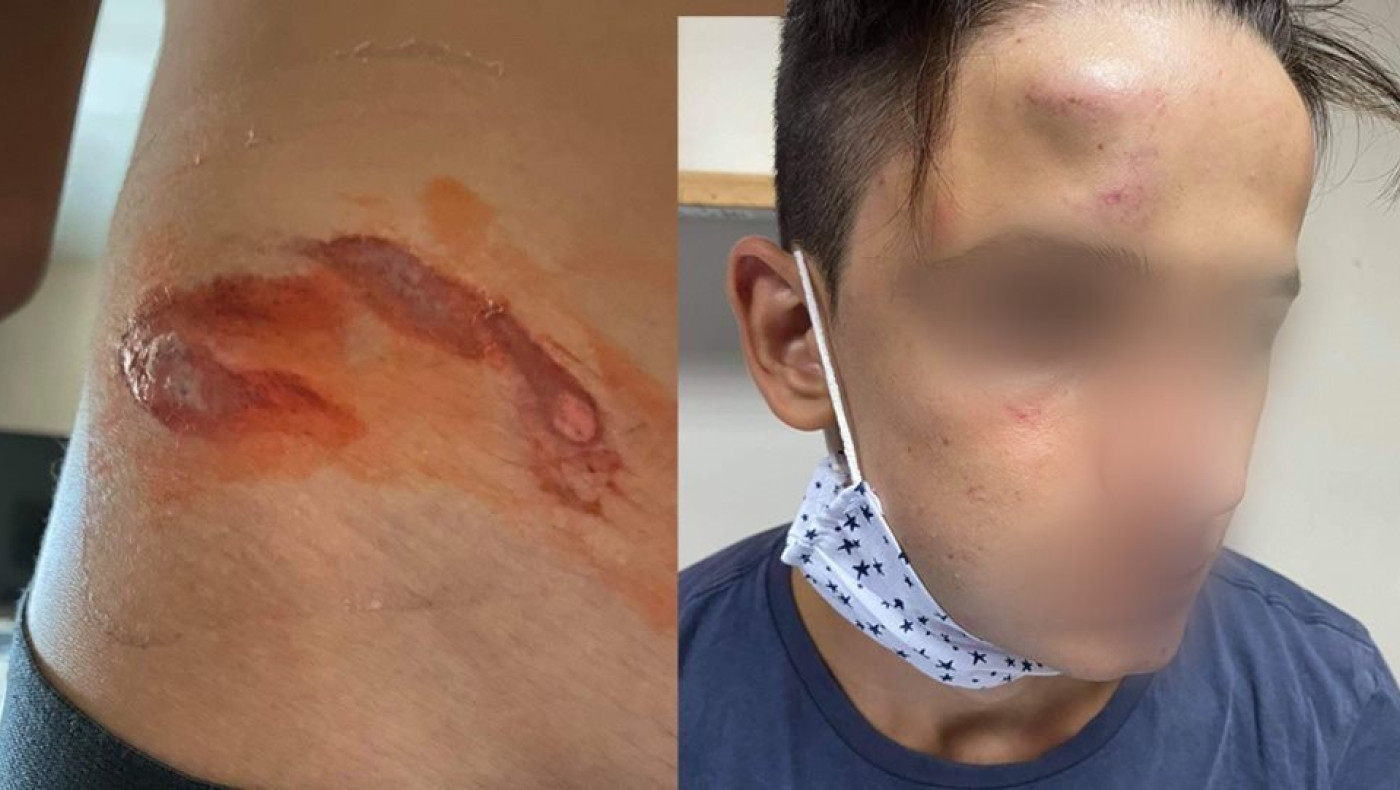 Ξυλοδαρμός 17χρονου στο Γαλάτσι: Συγκλονίζει η μαρτυρία του θύματος