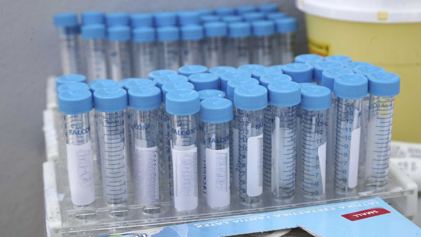 Χαλκιδική: Τι έβγαλαν τα rapid tests κορωνοϊού στο Πολύχρονο!