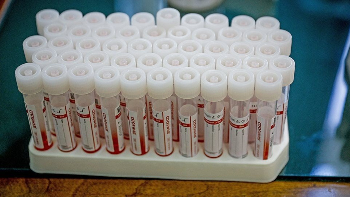 Θεσσαλονίκη: Καθυστερήσεις με τα τεστ κορωνοϊού