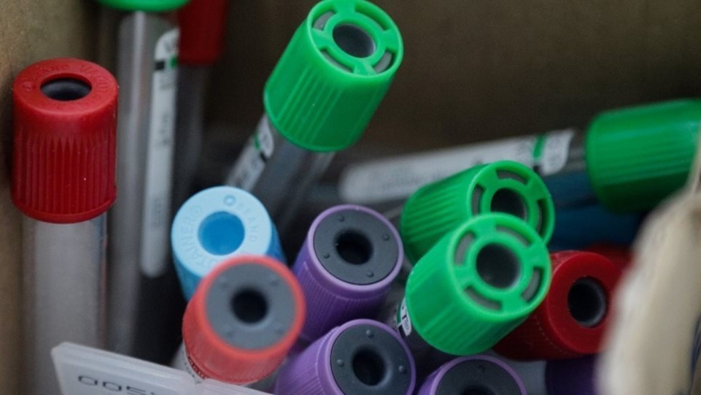 Θεσσαλονίκη: Τέσσερα Κέντρα Υγείας επιστρατεύονται στη μάχη κατά του κορωνοϊού