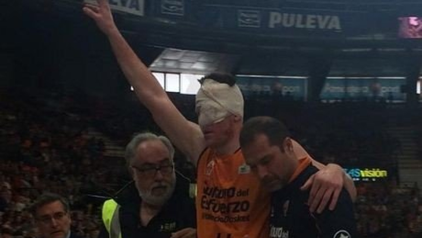 Τραυματισμός σοκ του Χαρανγκόντι (VIDEO)