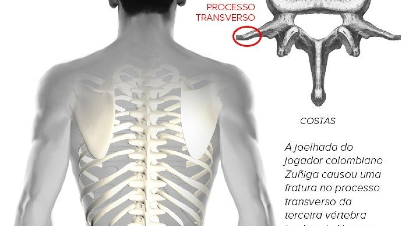 Ο κίνδυνος για αναπηρία και η αποθέωση του Νεϊμάρ (pic+video)