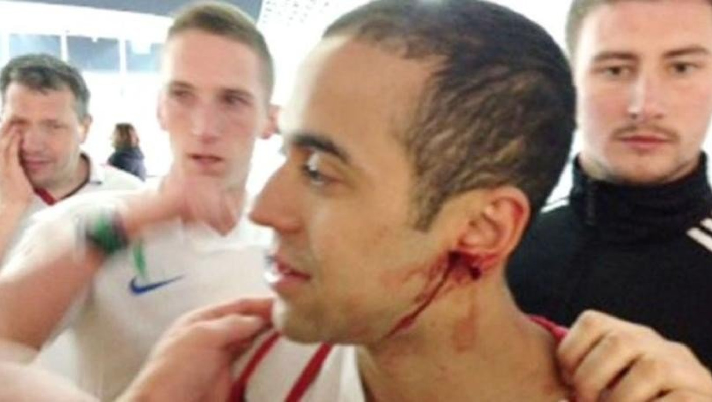 Άγγλος οπαδός δάγκωσε το αυτί Άγγλου οπαδού!