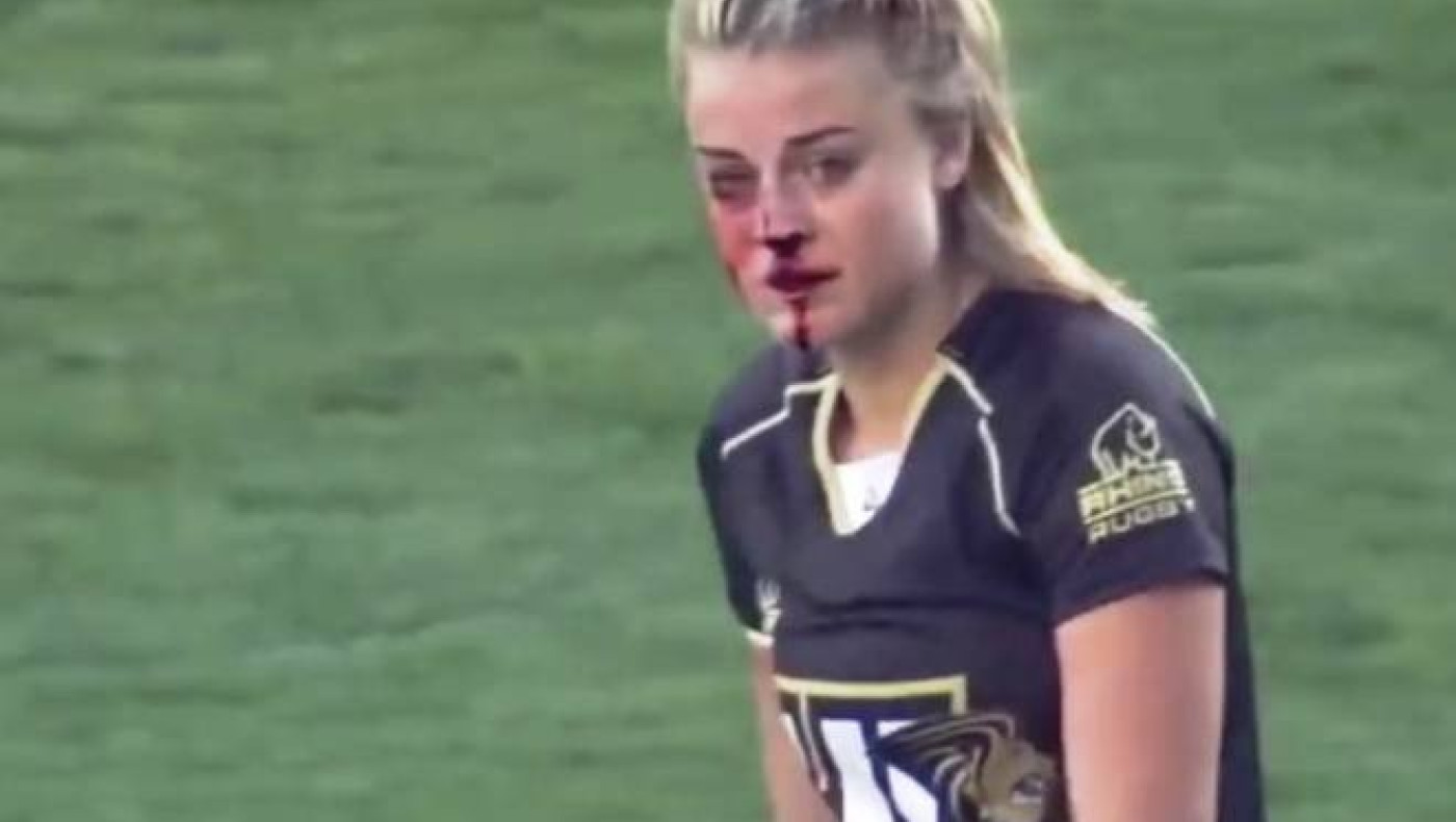 Πολύ ξύλο σε γυναικείο αγώνα ράγμπι! (video)