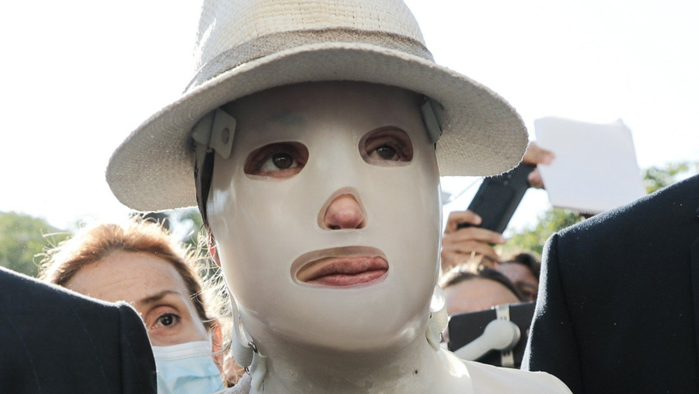 Ιωάννα: Με κοίταξε στα μάτια και μου έριξε το βιτριόλι -Ούρλιαζα, καιγόμουν, έλιωνα