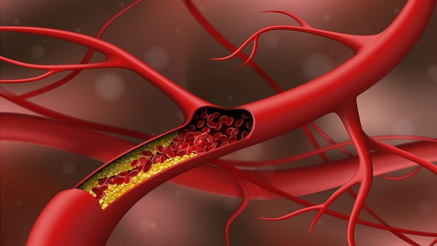 Χοληστερίνη: Τα σημάδια στα πόδια που δεν πρέπει να αγνοήσετε