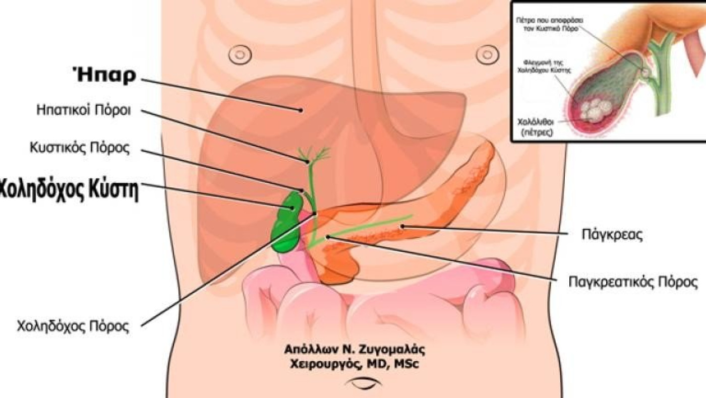 Τα 6 σημάδια που δείχνουν πρόβλημα στη χολή