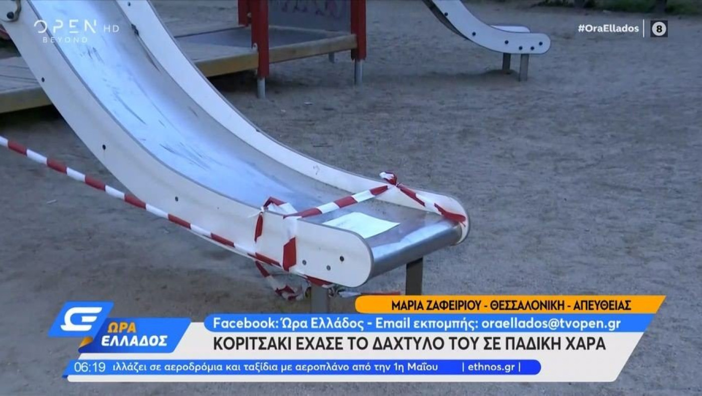 Θεσσαλονίκη: Τι απαντά ο χειρούργος της 8χρονης για την κατάσταση του δαχτύλου της