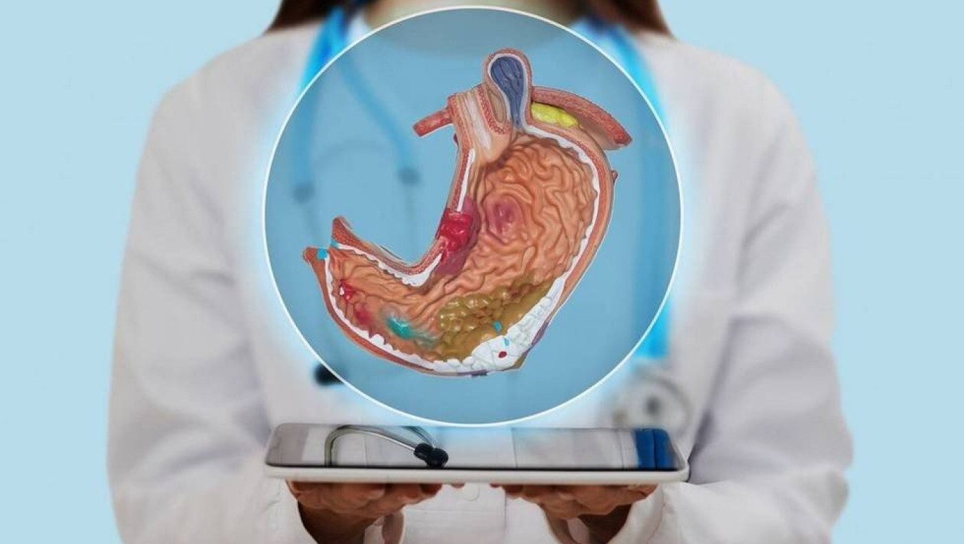 Σύνδρομο μηρυκασμού: Τα συμπτώματα, τα αίτια, οι επιβαρυντικοί παράγοντες και οι επιπλοκές