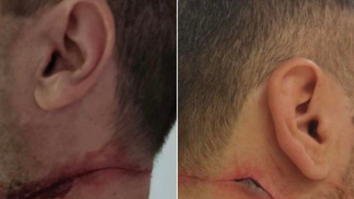 Αστυνομικοί δέχθηκαν επίθεση: «Μας ράντισε με ούρα και μας χαράκωσε στον λαιμό»