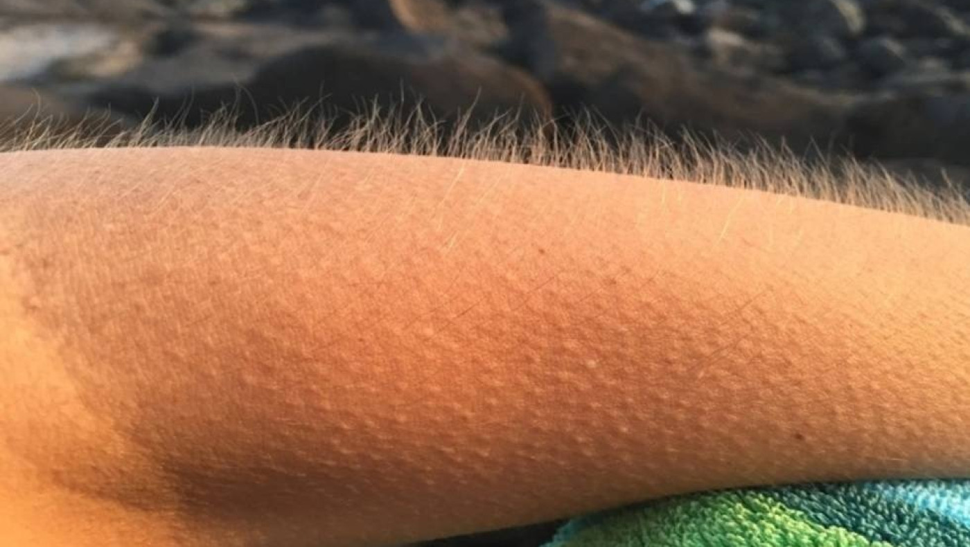 Όποιος κάνει τον εαυτό του να ανατριχιάζει έχει ιδιαίτερο εγκέφαλο