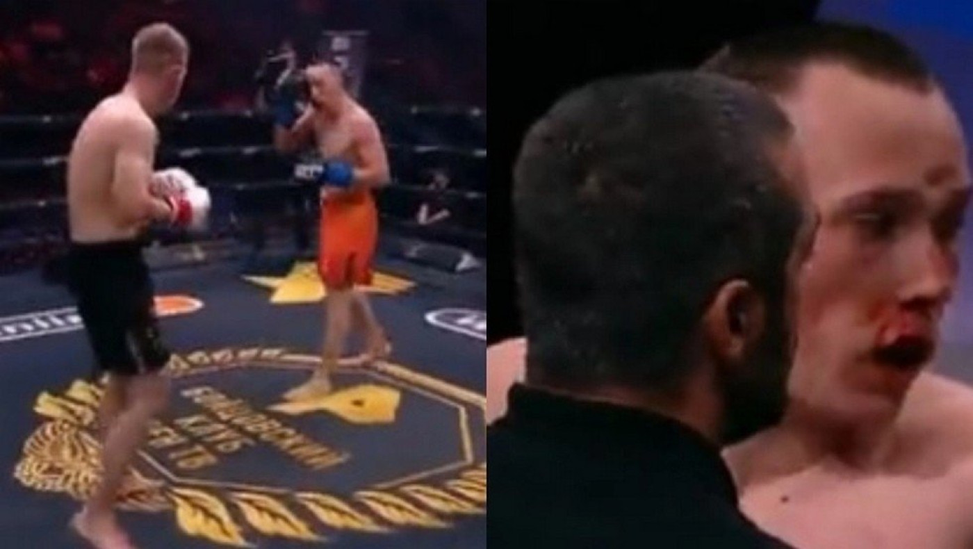 Δολοφονικό χτύπημα σε αγώνα kickboxing: Σχεδόν «διαλύθηκε» το κρανίο αθλητή