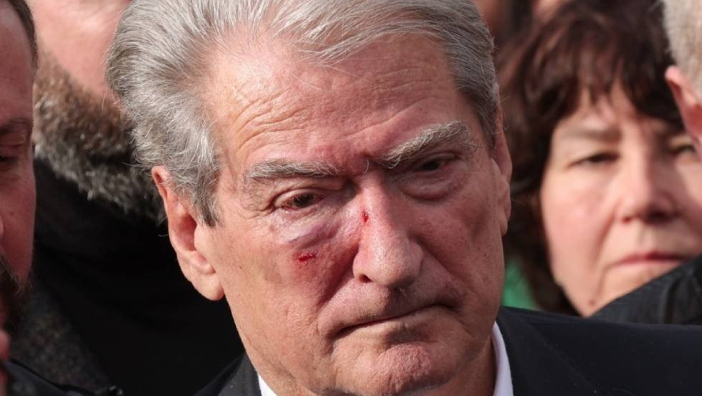 Αλβανία: Άγριος προπηλακισμός του Σαλί Μπερίσα με μπουνιές κατά την διάρκεια πορείας