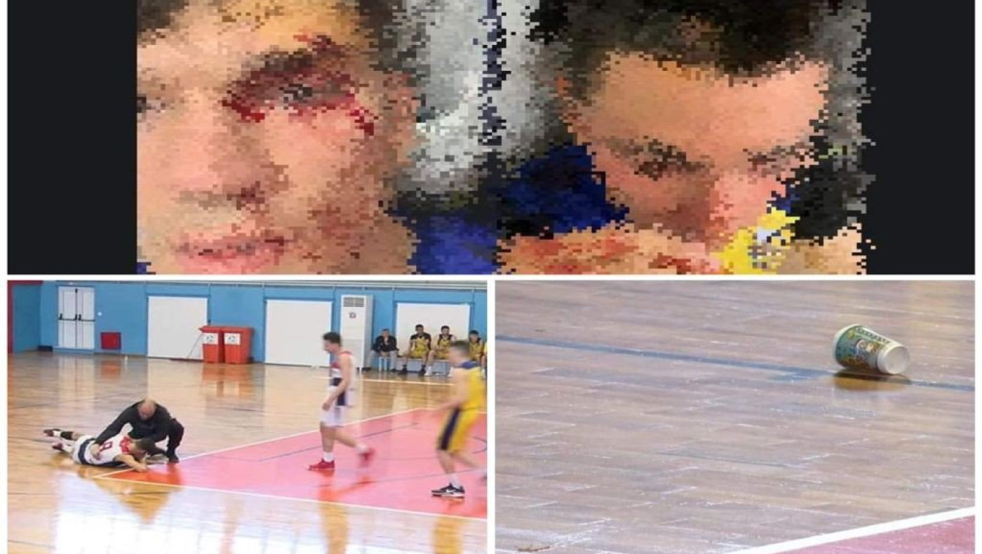 Χαλκιδική: Απειλές, ξύλο, αίματα και διακοπή σε αγώνα μπάσκετ Κ21