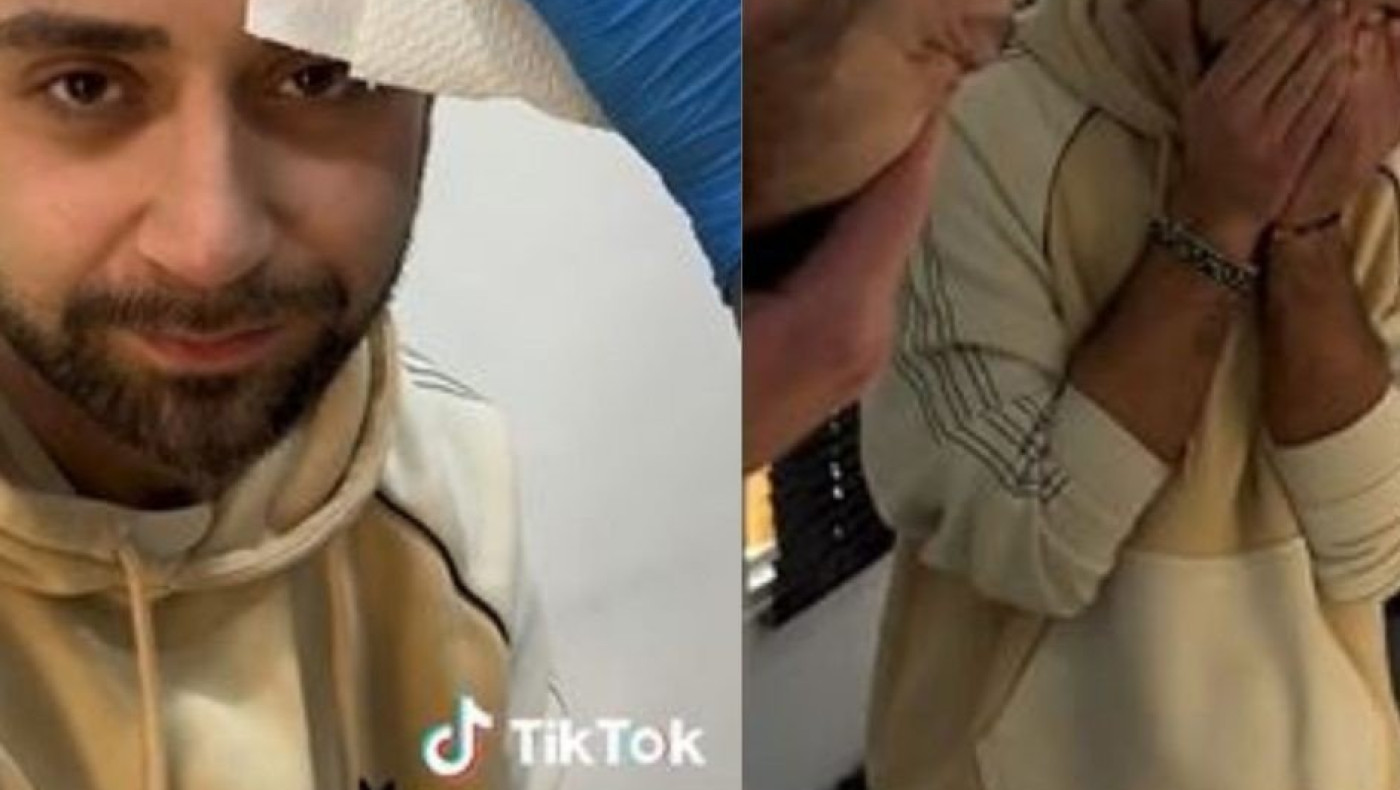 Άνδρας έκανε τατουάζ φράντζα για να «κρύψει» τη φαλάκρα του – Έμεινε άφωνος με το αποτέλεσμα