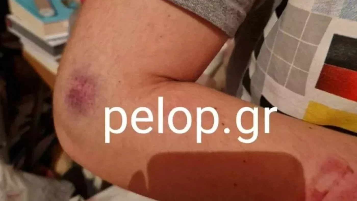 Πλάκωσε στο ξύλο την πρώην και συνελήφθη: «Θα σε σκοτώσω όταν βγω»