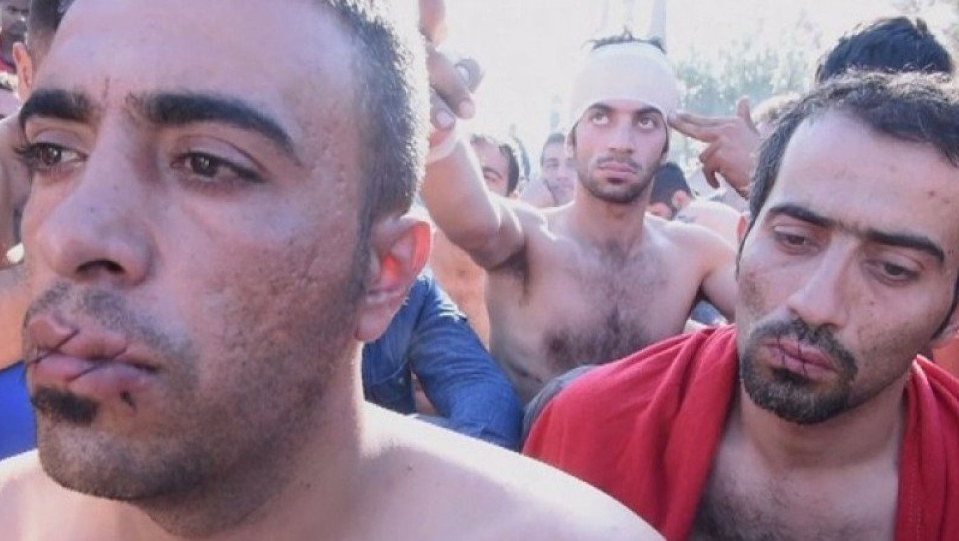 Μετανάστες διαμαρτύρονται ράβοντας το στόμα τους με βελόνι! (video)