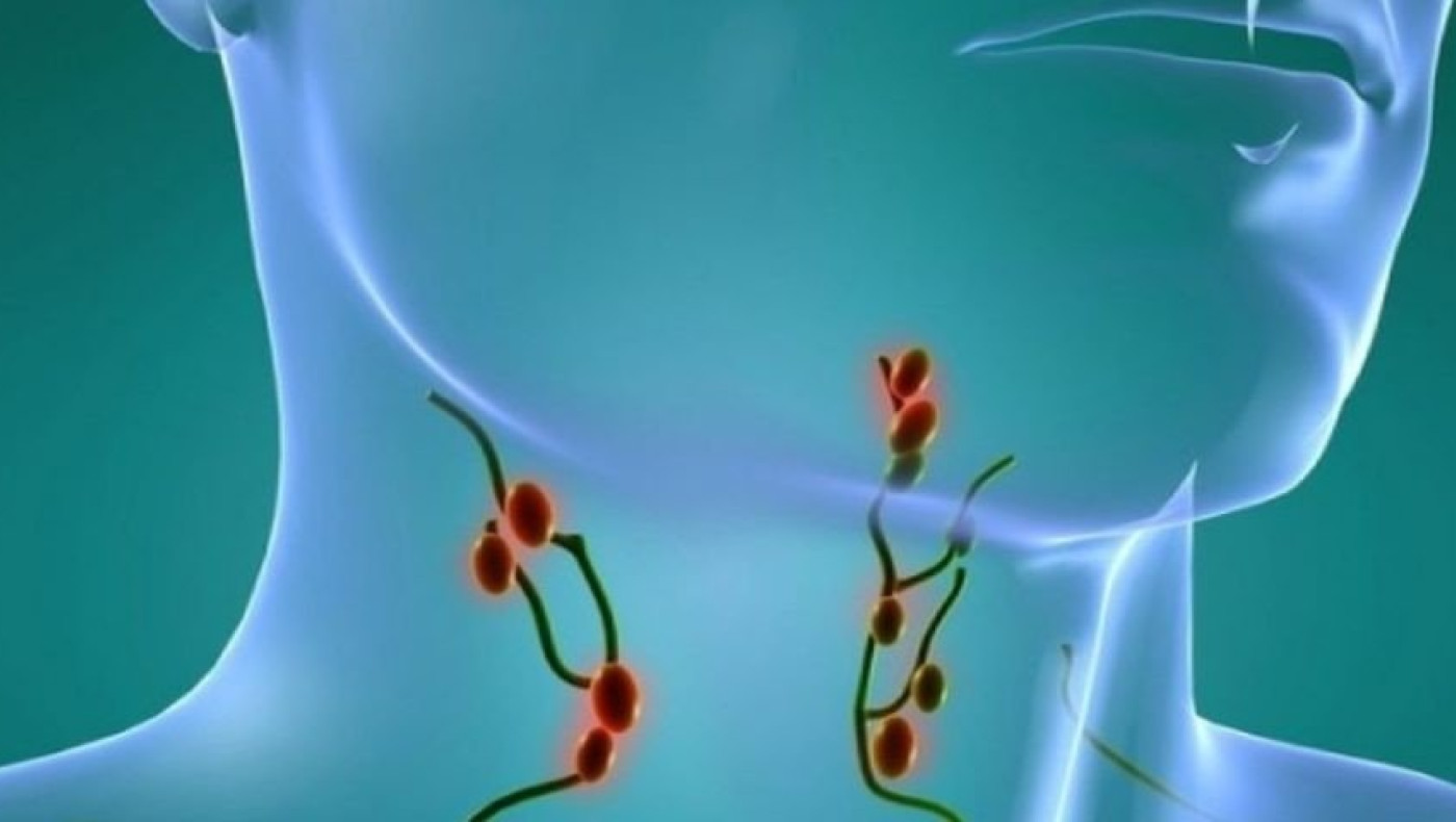 Λεμφαδένες χωρίς καρκίνο- Aναλυτικά τι πρέπει να γνωρίζετε