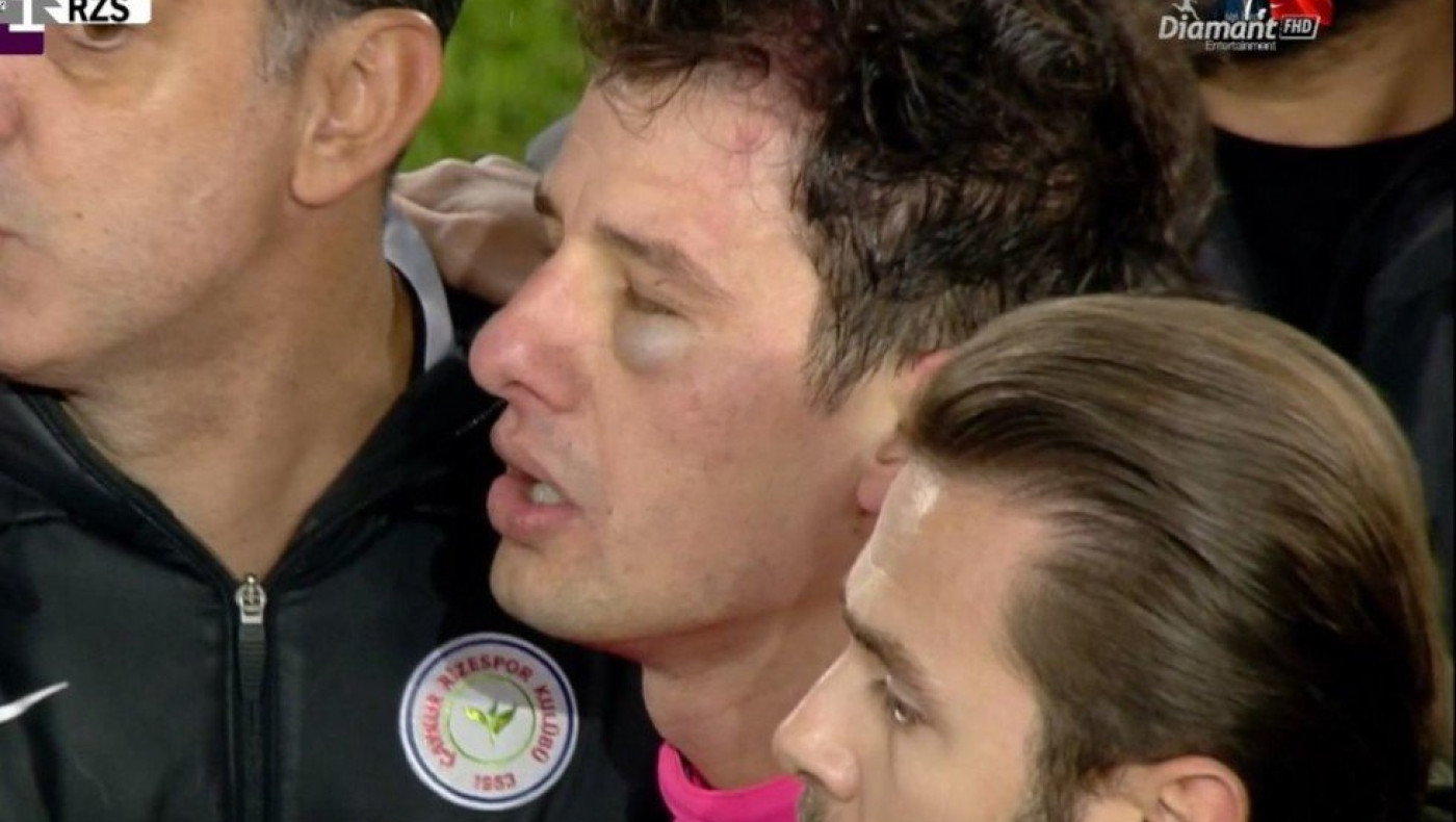 Τουρκία: Επίθεση με μπουνιές σε διαιτητή από τον πρόεδρο της Ανκαραγκουτσού