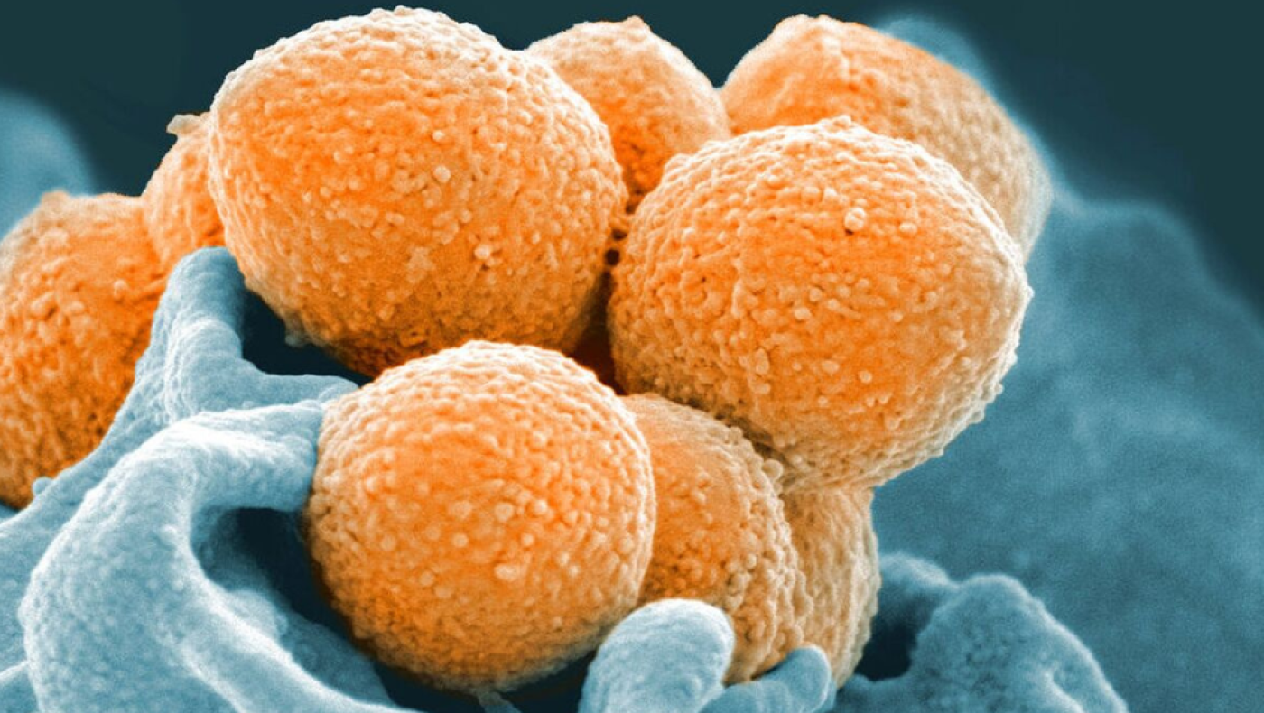 Στρεπτόκοκκος: Πώς μεταδίδεται και πώς μπορεί να σταματήσει