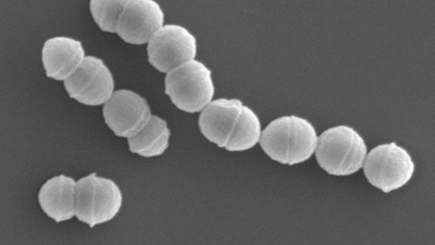 Σάλος στην Ιταλία με θανατηφόρα ασθένεια-Έλεγχοι στα αεροδρόμια!