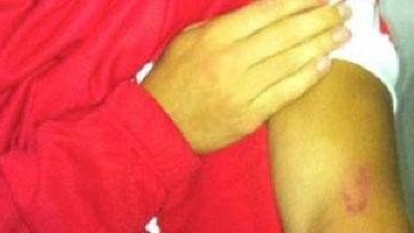 Ο Ιταλός... Σουάρες 