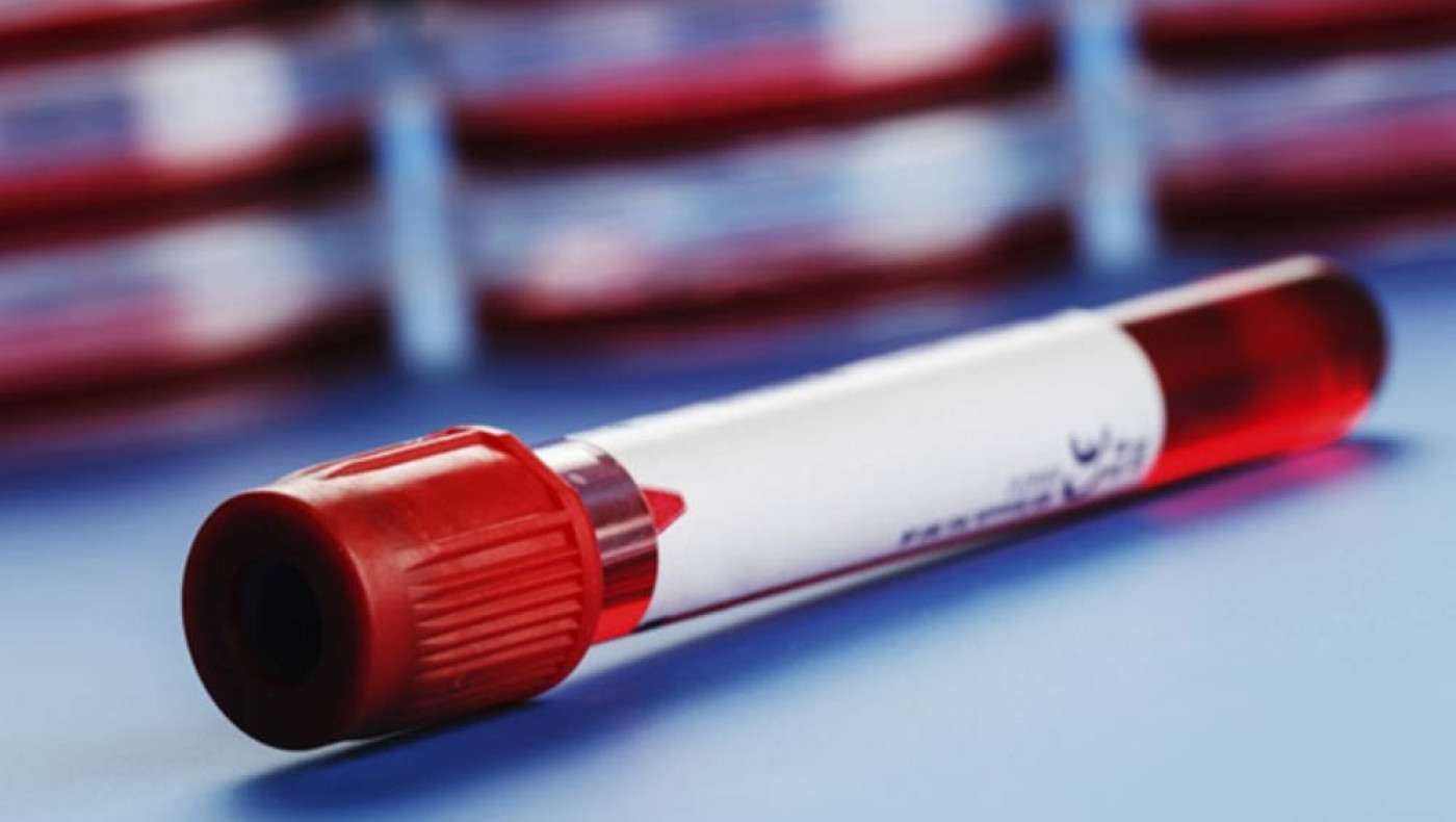 Με ποια ομάδα αίματος είναι πιθανότερο να διατηρηθούμε νέοι για περισσότερα χρόνια