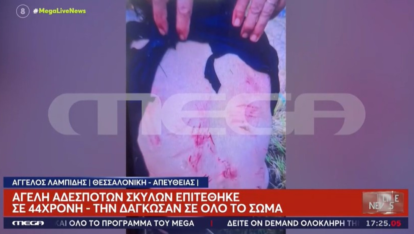 Συγκλονιστική μαρτυρία για την 44χρονη που δέχθηκε επίθεση από σκύλους (vids)