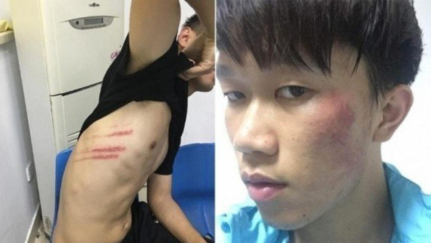 Σοκαριστικό ξύλο στους ποδοσφαιριστές της Τζιανγκσού (vid)