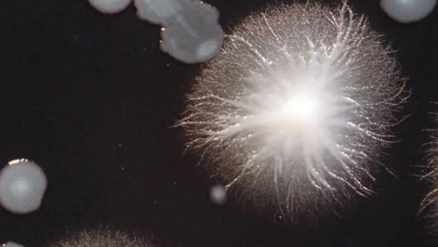 «Νόσος των Λεγεωνάριων»: Τι είναι και πώς μεταδίδεται