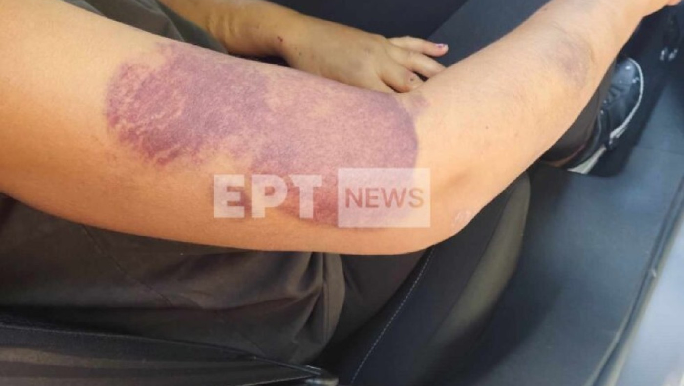 Διδυμότειχο: Προφυλακιστέος ο 32χρονος που κατηγορείται ότι κρατούσε φυλακισμένη και βίαζε τη σύντροφό του