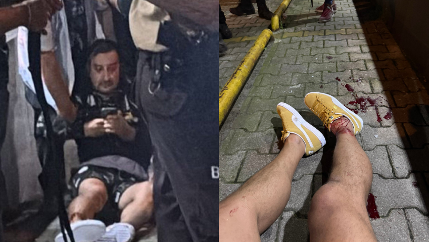 Ποιος είναι ο Σερχάτ Ακίν που πυροβόλησαν μετά το Φενέρ - Ουνιόν Σεν Ζιλουάζ!