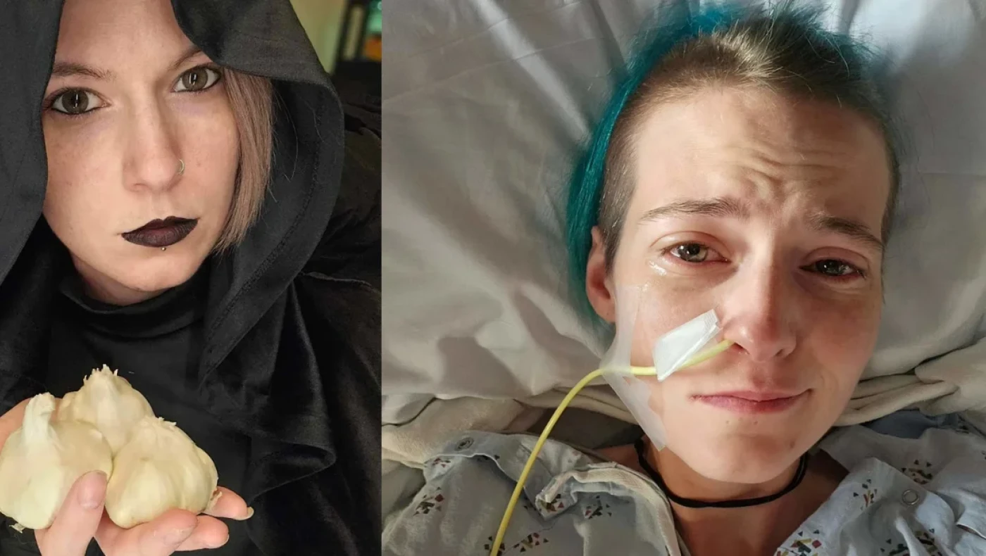 Γυναίκα ζει με τη σπάνια «ασθένεια των βαμπίρ» όπως ο Κόμης Δράκουλας