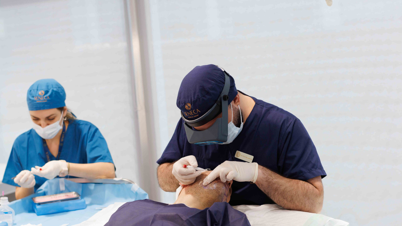 Tα δύσκολα περιστατικά μεταμόσχευσης μαλλιών-Οι ιατρικές προκλήσεις που πρέπει να αντιμετωπιστούν