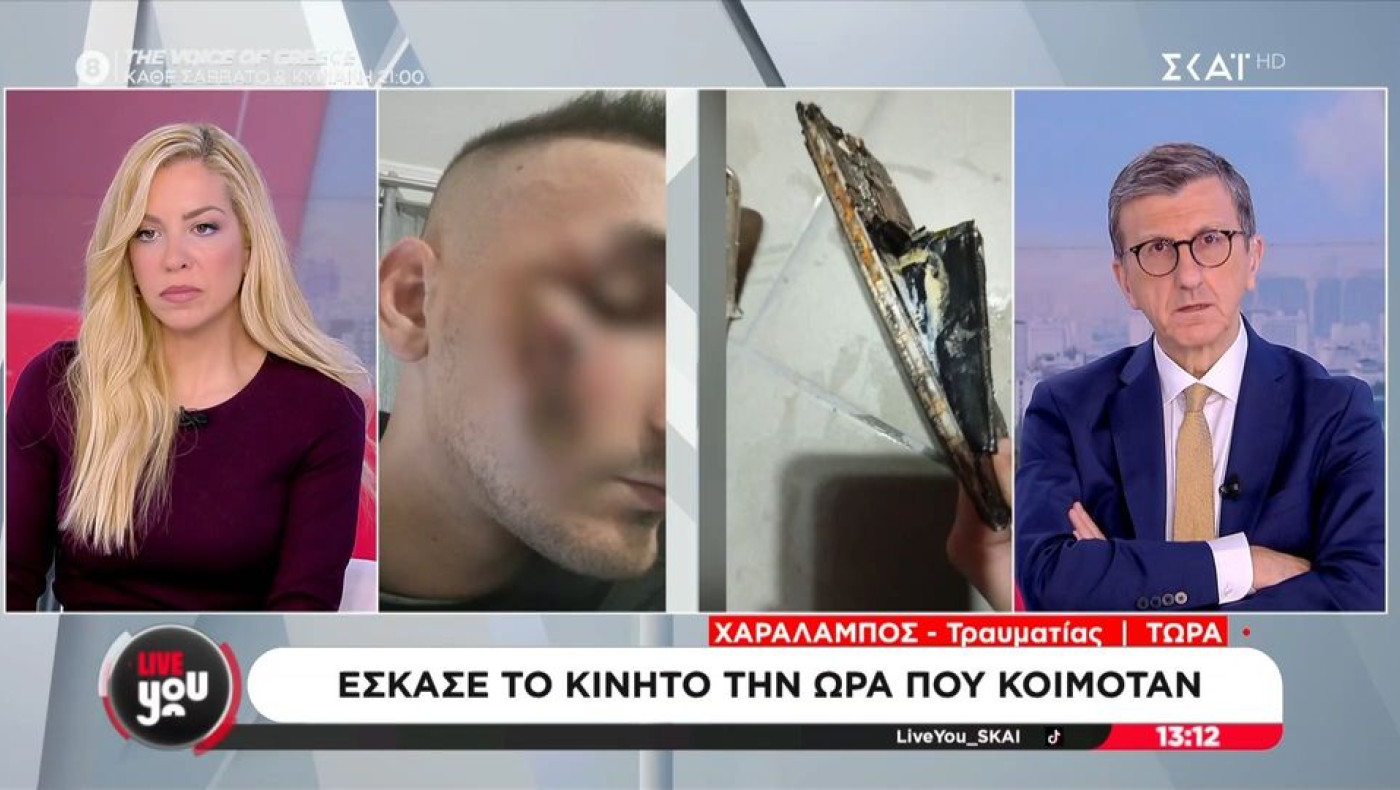 Έσκασε το κινητό ενώ κοιμόταν! - «Θα κινηθώ κατά παντός υπευθύνου - Έχει κλείσει το μισό μου μάτι»