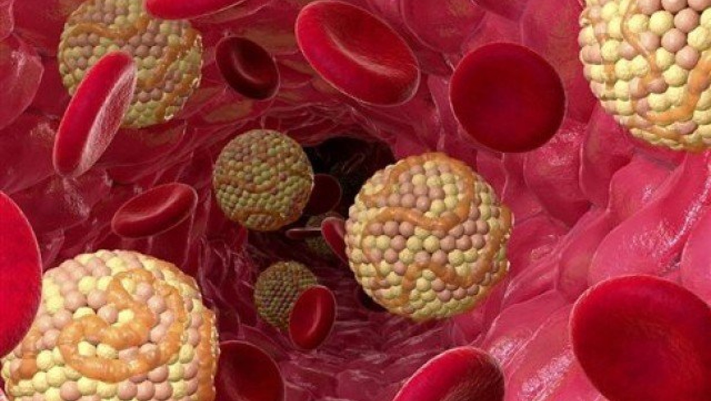 Οι διακυμάνσεις της χοληστερόλης κάνουν κακό στον εγκέφαλο