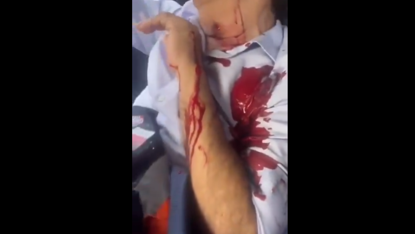 Υποψήφιος δήμαρχος «έστησε» απόπειρα δολοφονίας του και βρέθηκε στην εντατική!