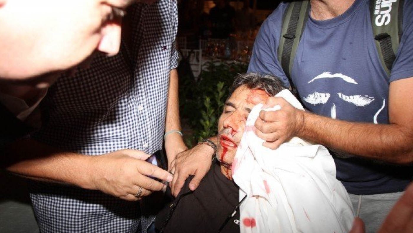 ΕΚΤΑΚΤΟ: Επίθεση κουκουλοφόρων και ξύλο στην κλήρωση της Φούτμπολ Λιγκ