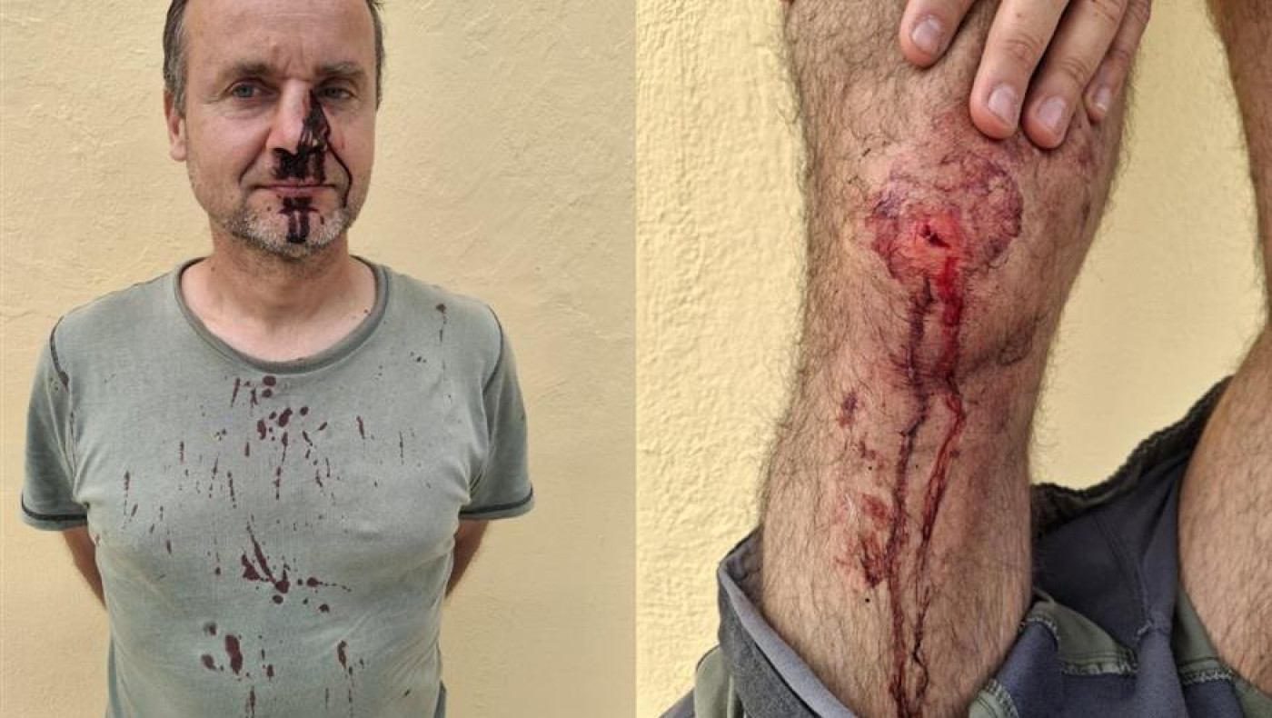 Ντροπιαστικές εικόνες στη Ζάκυνθο: Κυνηγοί ξυλοκόπησαν εθελοντές