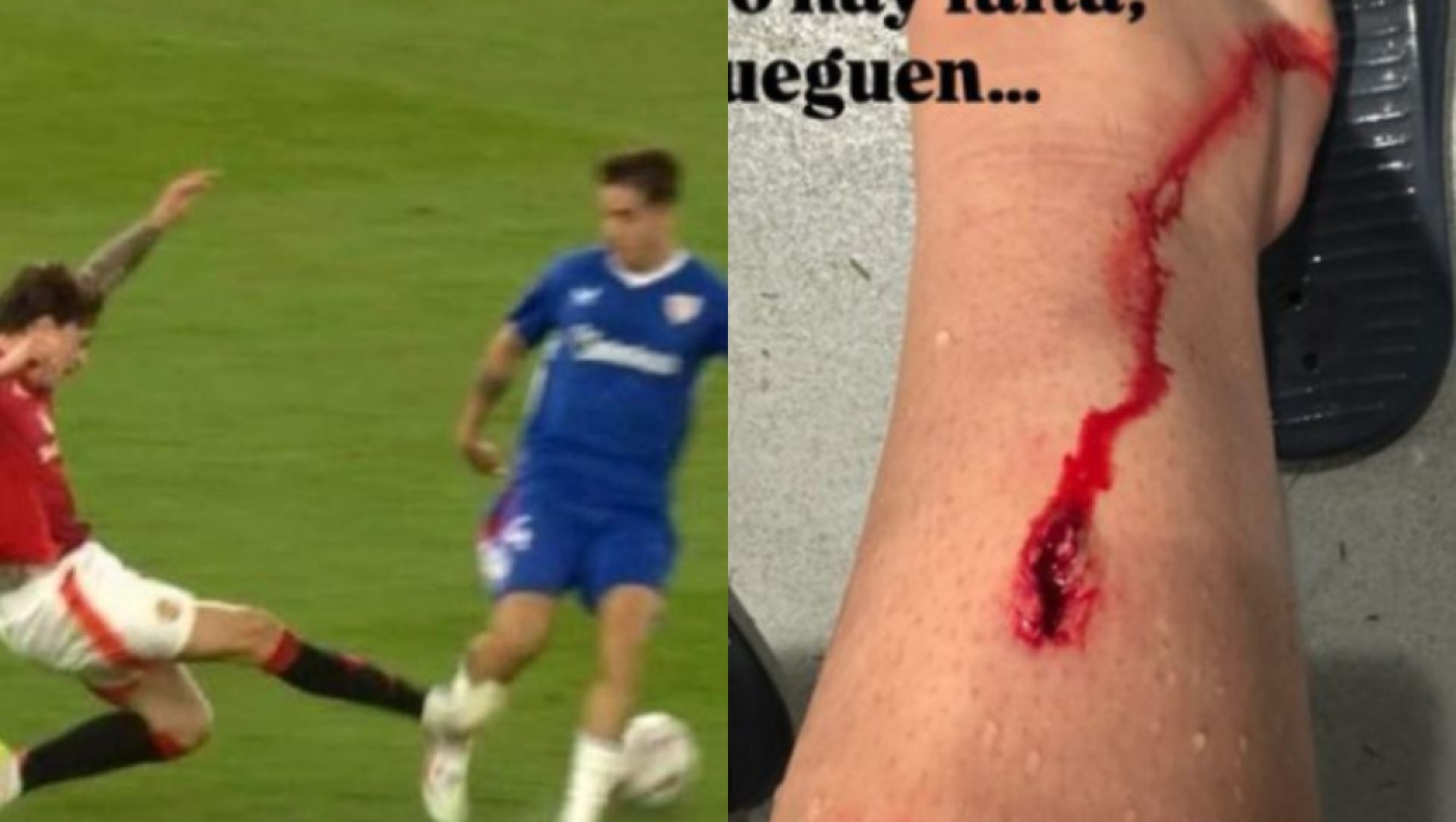 Europa League: Το σημάδι στο πόδι του Πράντος